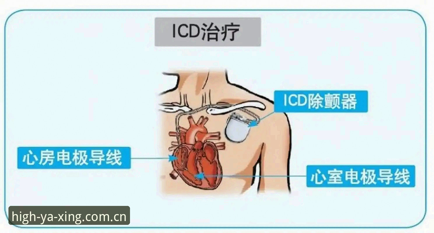 陪你一路高光拼音版数据查询怎么下载 心脏除颤器能改写命运吗?埃里克森第二次倒地,34岁还能再战多久?
